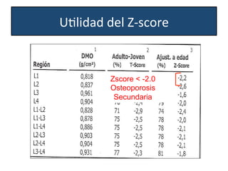Zscore < -2.0
Osteoporosis
Secundaria
UWlidad	
  del	
  Z-­‐score	
  
 