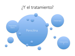 ¿Y el tratamiento?
Penicilina
Tratamiento
tópico
Fototerapia
Ciclosporina
A
 