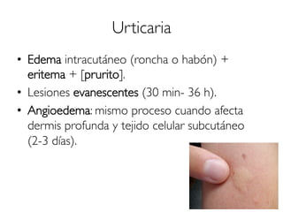 Urticaria
•  Edema intracutáneo (roncha o habón) +
eritema + [prurito].
•  Lesiones evanescentes (30 min- 36 h).
•  Angioedema: mismo proceso cuando afecta
dermis profunda y tejido celular subcutáneo
(2-3 días).
 