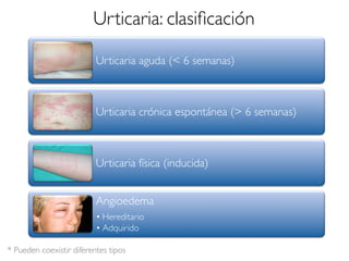 Urticaria: clasiﬁcación
Urticaria aguda (< 6 semanas)
Urticaria crónica espontánea (> 6 semanas)
Urticaria física (inducida)
Angioedema
• Hereditario
• Adquirido
* Pueden coexistir diferentes tipos
 