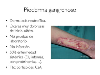 Pioderma gangrenoso
•  Dermatosis neutrofílica.
•  Úlceras muy dolorosas
de inicio súbito.
•  No pruebas de
laboratorio.
•  No infección.
•  50% enfermedad
sistémica (EII, linfomas,
paraproteinemias…).
•  Tto: corticoides, CsA.
 