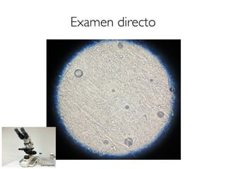 Examen directo
 