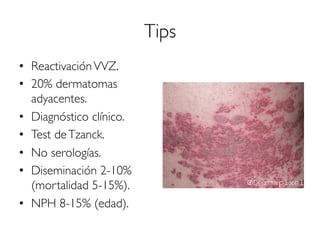 Tips
•  ReactivaciónVVZ.
•  20% dermatomas
adyacentes.
•  Diagnóstico clínico.
•  Test deTzanck.
•  No serologías.
•  Diseminación 2-10%
(mortalidad 5-15%).
•  NPH 8-15% (edad).
 