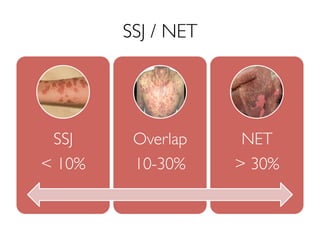 SSJ / NET
SSJ
< 10%
Overlap
10-30%
NET
> 30%
 