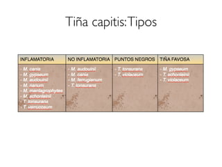 Tiña capitis:Tipos
 