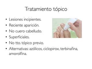 Tratamiento tópico
•  Lesiones incipientes.
•  Reciente aparición.
•  No cuero cabelludo.
•  Superﬁciales.
•  No tto. tópico previo.
•  Alternativas: azólicos, ciclopirox, terbinaﬁna,
amorolﬁna.
 