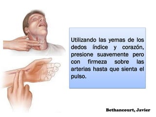 Utilizando las yemas de los
dedos índice y corazón,
presione suavemente pero
con firmeza sobre las
arterias hasta que sienta el
pulso.
Bethancourt, Javier
 