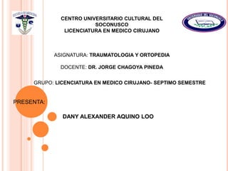 CENTRO UNIVERSITARIO CULTURAL DEL
SOCONUSCO
LICENCIATURA EN MEDICO CIRUJANO
ASIGNATURA: TRAUMATOLOGIA Y ORTOPEDIA
DOCENTE: DR. JORGE CHAGOYA PINEDA
GRUPO: LICENCIATURA EN MEDICO CIRUJANO- SEPTIMO SEMESTRE
DANY ALEXANDER AQUINO LOO
PRESENTA:
 