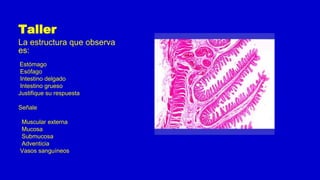 Taller
La estructura que observa
es:
Estómago
Esófago
Intestino delgado
Intestino grueso
Justifique su respuesta
Señale
Muscular externa
Mucosa
Submucosa
Adventicia
Vasos sanguíneos
 