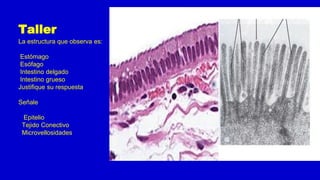 Taller
La estructura que observa es:
Estómago
Esófago
Intestino delgado
Intestino grueso
Justifique su respuesta
Señale
Epitelio
Tejido Conectivo
Microvellosidades
 