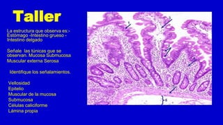 Taller
La estructura que observa es:-
Estómago -Intestino grueso -
Intestino delgado
Señale las túnicas que se
observan. Mucosa Submucosa
Muscular externa Serosa
Identifique los señalamientos.
Vellosidad
Epitelio
Muscular de la mucosa
Submucosa
Células caliciforme
Lámina propia
 