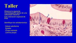 Taller
Observe la siguiente
microfotografía óptica de una
vellosidad intestinal
Con coloración especial de
PAS
Identifique los señalamientos:
Célula caliciforme
Epitelio
Chapa estriada
Lámina propia
 