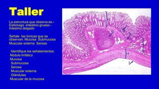 Taller
La estructura que observa es:-
Estómago -Intestino grueso -
Intestino delgado
Señale las túnicas que se
observan. Mucosa Submucosa
Muscular externa Serosa
Identifique los señalamientos.
Nódulo linfático
Mucosa
Submucosa
Serosa
Muscular externa
Glándulas
Muscular de la mucosa
 