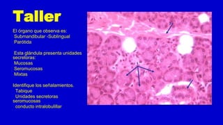 Taller
El órgano que observa es:
Submandibular -Sublingual
Parótida
Esta glándula presenta unidades
secretoras:
Mucosas
Seromucosas
Mixtas
Identifique los señalamientos.
Tabique
Unidades secretoras
seromucosas
conducto intralobulillar
 