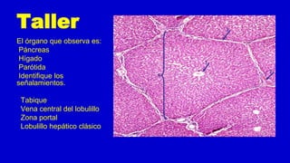 Taller
El órgano que observa es:
Páncreas
Hígado
Parótida
Identifique los
señalamientos.
Tabique
Vena central del lobulillo
Zona portal
Lobulillo hepático clásico
 