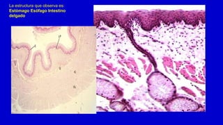 La estructura que observa es:
Estómago Esófago Intestino
delgado
 