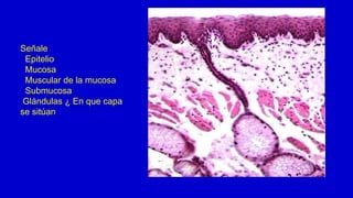 Señale
Epitelio
Mucosa
Muscular de la mucosa
Submucosa
Glándulas ¿ En que capa
se sitúan
 