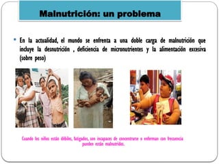 En la actualidad, el mundo se enfrenta a una doble carga de malnutrición que
incluye la desnutrición , deficiencia de micronutrientes y la alimentación excesiva
(sobre peso)
Malnutrición: un problema
Cuando los niños están débiles, fatigados, son incapaces de concentrarse o enferman con frecuencia
pueden están malnutridos.
 