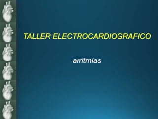 TALLER ELECTROCARDIOGRAFICO
arritmias
 