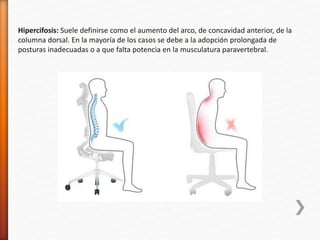 Hipercifosis: Suele definirse como el aumento del arco, de concavidad anterior, de la 
columna dorsal. En la mayoría de los casos se debe a la adopción prolongada de 
posturas inadecuadas o a que falta potencia en la musculatura paravertebral. 
 