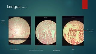 Saliva
Fibra muscular
estriada
Tejido conectivo denso irregular
Musculo esquelético
Papila filiforme
Lamina
propia
Lengua placa #2
 