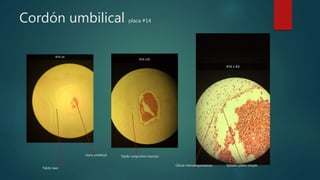 Cordón umbilical placa #14
Tejido laxo
Tejido conjuntivo mucoso
Epitelio plano simple
Vena umbilical
Célula mensenquimatosa
 