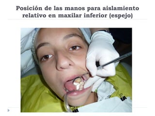 Posición de las manos para aislamiento
relativo en maxilar inferior (espejo)

 