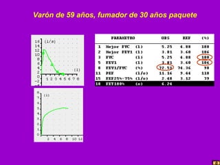 Varón de 59 años, fumador de 30 años paquete

 