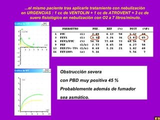 ...el mismo paciente tras aplicarle tratamiento con nebulización
en URGENCIAS : 1 cc de VENTOLIN + 1 cc de ATROVENT + 3 cc de
suero fisiológico en nebulización con O2 a 7 litros/minuto.

Obstrucción severa
con PBD muy positiva 45 %
Probablemente además de fumador
sea asmático.

 