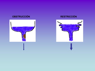 OBSTRUCCIÓN   RESTRICCIÓN
 