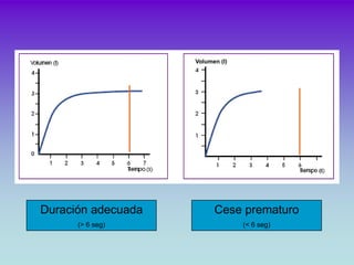 Volumen (l)




Duración adecuada         Cese prematuro
      (> 6 seg)                   (< 6 seg)
 