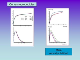 Curvas reproducibles




                            Mala
                       reproducibilidad
 