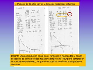 …varón, 60 a, fumador.. Disnea de moderados esfuerzos




                         Curvas NO aceptables


Inicio no rapido...