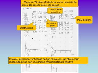 …varón, 42 a, Obesidad (IMC 42).. Consulta por dísnea

Restricción




       Para confirmar la restricción es necesario r...