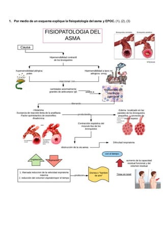 1. Por medio de un esquema explique la fisiopatología del asma y EPOC. (1), (2), (3)
 