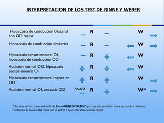 Taller hipoacusia | PPT