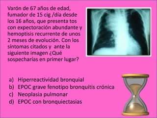Varón de 67 años de edad,
fumador de 15 cig /día desde
los 16 años, que presenta tos
con expectoración abundante y
hemoptisis recurrente de unos
2 meses de evolución. Con los
síntomas citados y ante la
siguiente imagen ¿Qué
sospecharías en primer lugar?


a)   Hiperreactividad bronquial
b)   EPOC grave fenotipo bronquitis crónica
c)   Neoplasia pulmonar
d)   EPOC con bronquiectasias
 