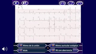 Ritmo Riva Taller interactivo de electrocardiografía en cardiopatía coronaria | PDF
