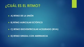 Ritmo Riva Taller interactivo de electrocardiografía en cardiopatía coronaria | PDF