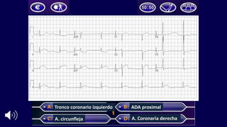 Tronco	coronario	izquierdo
A.	circunfleja
ADA	proximal
A.	Coronaria	derecha
 