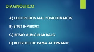 DIAGNÓSTICO
A) ELECTRODOS MAL POSICIONADOS
B) SITUS INVERSUS
C) RITMO AURICULAR BAJO
D) BLOQUEO DE RAMA ALTERNANTE
 