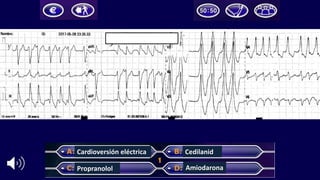 Cardioversión	eléctrica
Propranolol
Cedilanid
Amiodarona
 