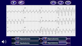 Hipocalcemia
Hipokalemia
Hipercalcemia
Hiperkalemia
 
