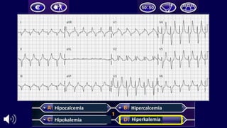 Hipocalcemia
Hipokalemia
Hipercalcemia
Hiperkalemia
 
