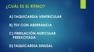 ¿CUÁL ES EL RITMO?
A) TAQUICARDIA VENTRICULAR
B) TSV CON ABERRANCIA
C) FIBRILACIÓN AURICULAR
PREEXCITADA
D) TAQUICARDIA SINUSAL
 
