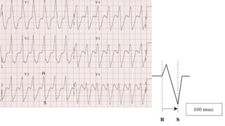 XII CURSO ANUAL DE POSTGRADO
Toma de decisiones e Cardiología y
Cirugía Cardiovascular
 