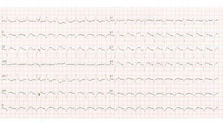 XII CURSO ANUAL DE POSTGRADO
Toma de decisiones e Cardiología y
Cirugía Cardiovascular
 