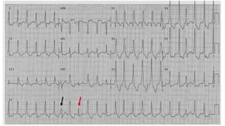 XII CURSO ANUAL DE POSTGRADO
Toma de decisiones e Cardiología y
Cirugía Cardiovascular
 