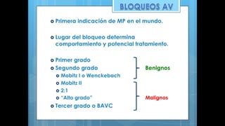 › Primera indicación de MP en el mundo.
› Lugar del bloqueo determina
comportamiento y potencial tratamiento.
› Primer grado
› Segundo grado Benignos
› Mobitz I o Wenckebach
› Mobitz II
› 2:1
› “Alto grado” Malignos
› Tercer grado o BAVC
 