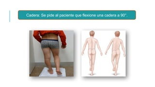 Taller Malformaciones y alteraciones ortopedicas DMOJ FINAL ...